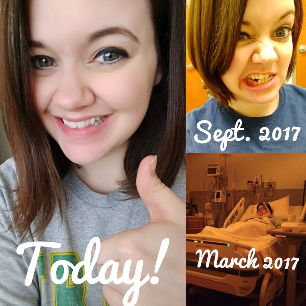 Kelsey's Surgery Collage